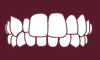 Crossbite