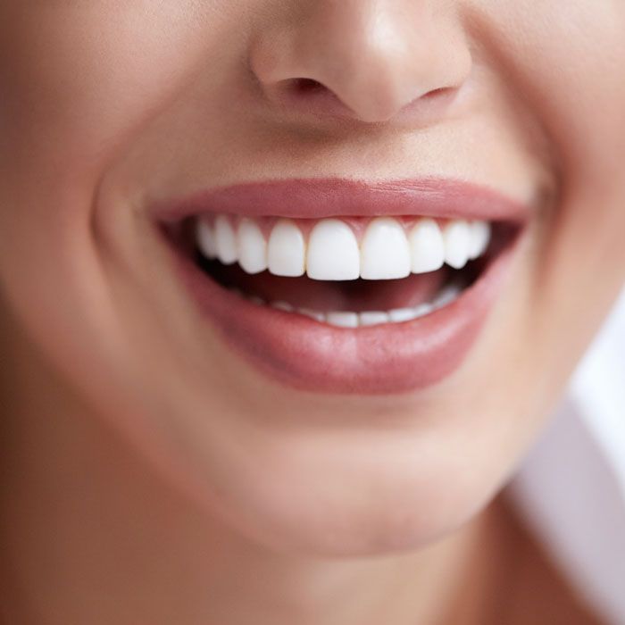 Dental veneers home page