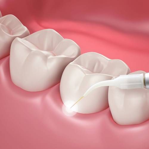 Laser dentistry home page