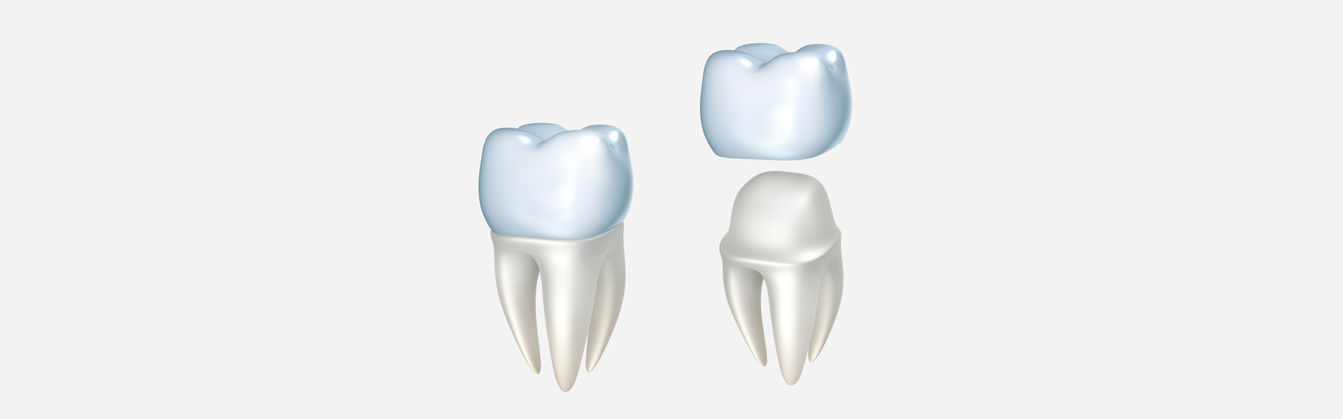6 Things You Don’t Know About Dental Crowns